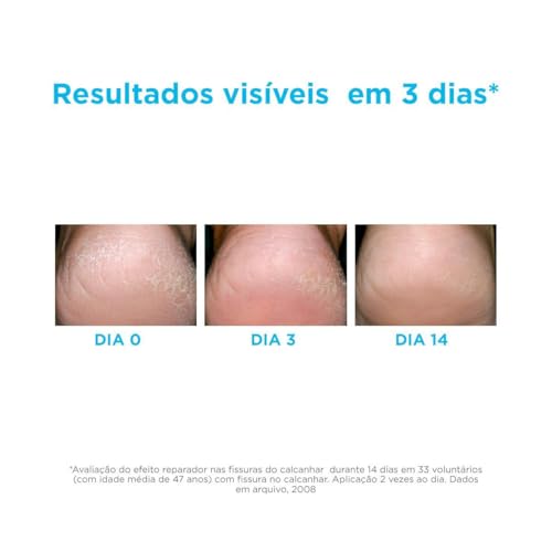 ISDIN Hidratante para os Pés Ureadin Podos - Deslumbre com a Pele mais Radiante! 7